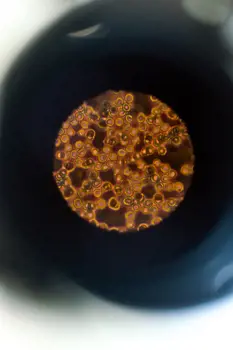 Blood cells seen through a microscope