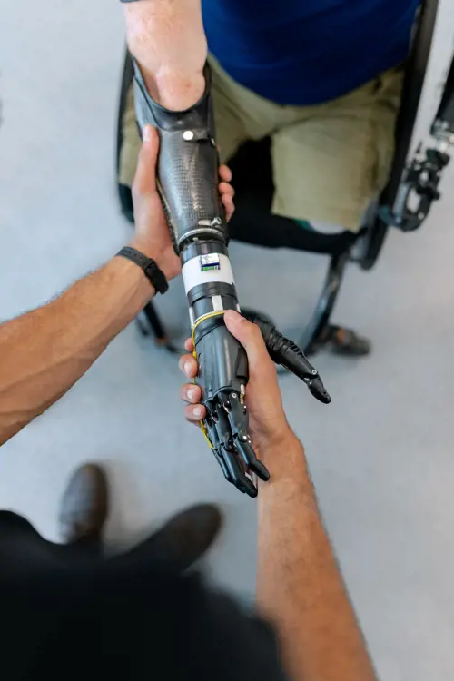 Robotics engineer installing a prosthetic arm